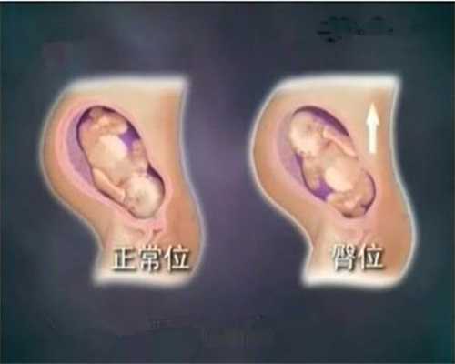 武汉代孕要求_武汉代孕女人_印度人最宝贝的2种